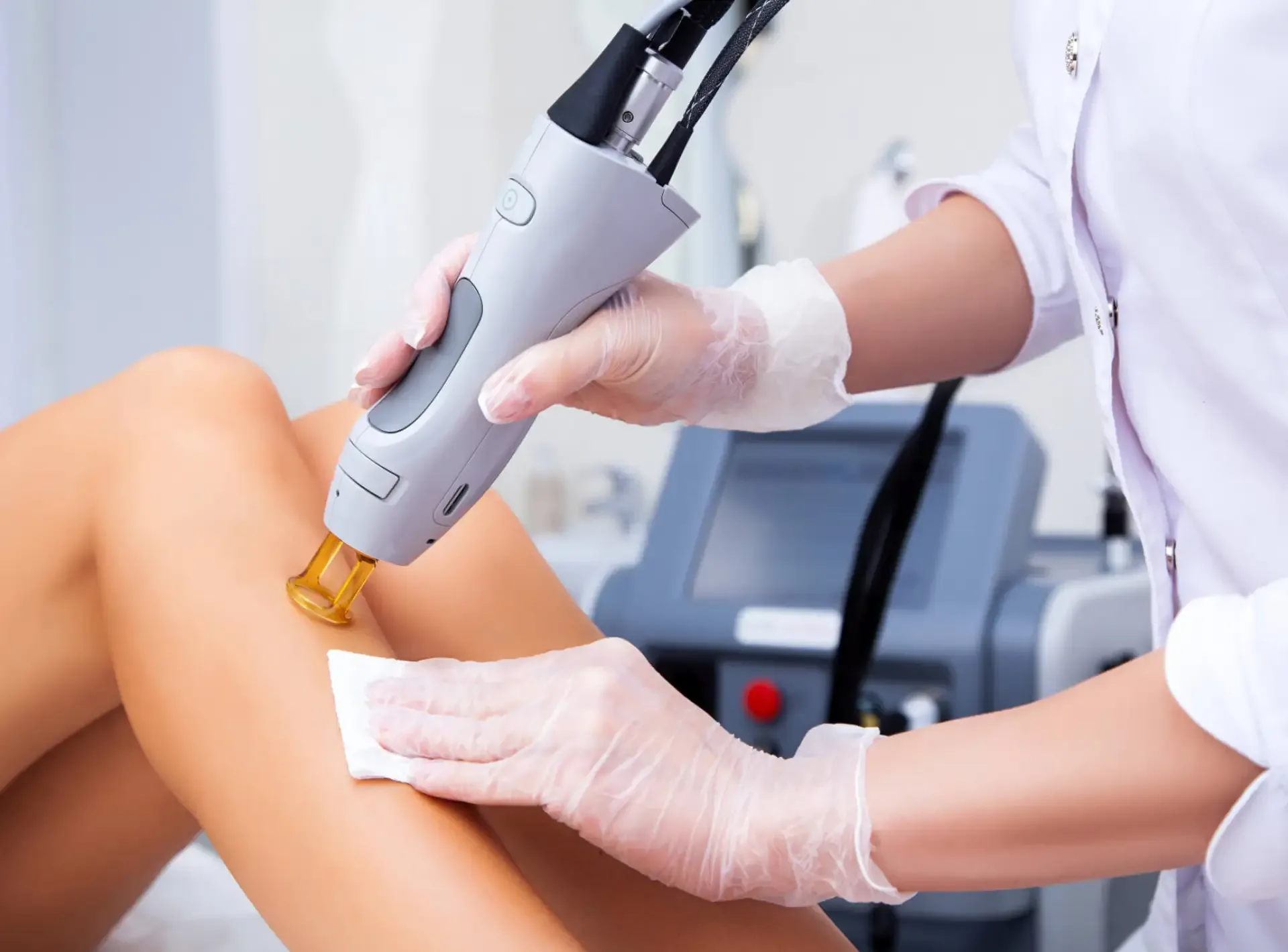 Epilare laser pentru femei